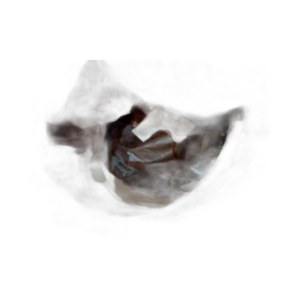 RING JOINT